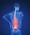 Mal-de-dos-fitness sport sante lunel